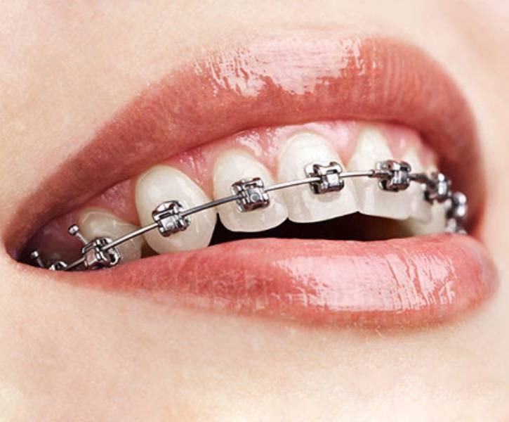Orthodontics